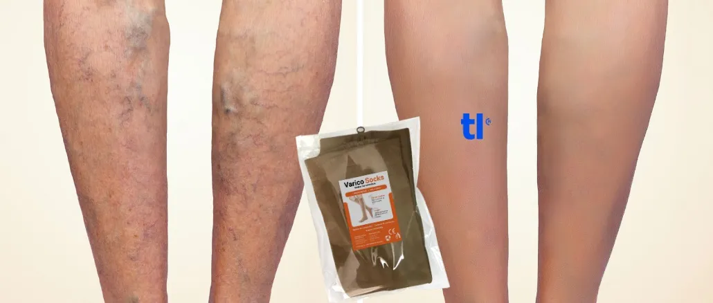 Varcosin